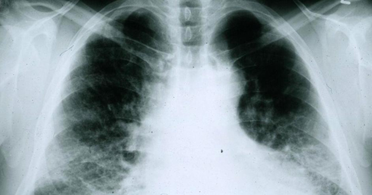 Doctors in the UK must ask men whether they are pregnant before having an X-ray