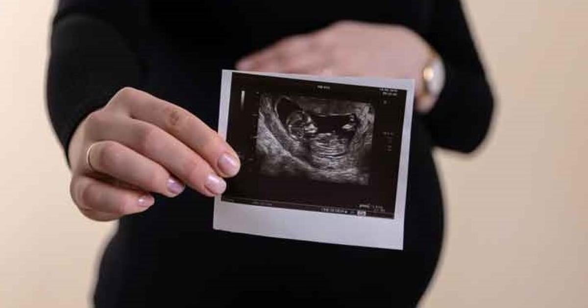 Cristianos y musulmanes se unen en un histórico documento en defensa de la vida y contra el aborto Cristianos y musulmanes se unen en un histórico documento en defensa de la vida y contra el aborto
