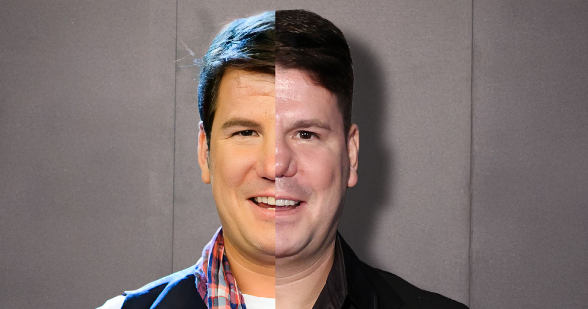 Qué le ha pasado a Lucas, del dúo Andy y Lucas, en la nariz