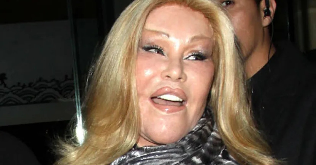 猫のように見せるための手術に数百万ドルを費やした女性、ジョセリン・ウィルデンスタインさんが死去